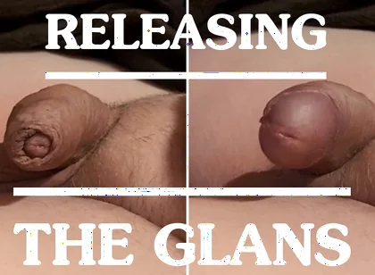 Releasing the Glans From the Foreskin - a Compilation