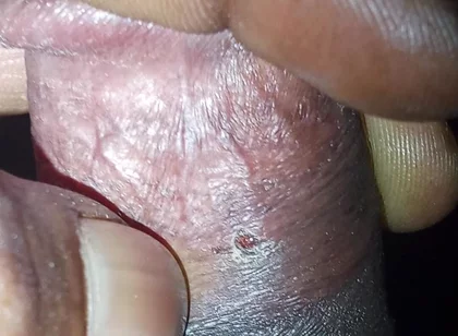 Now Videos
