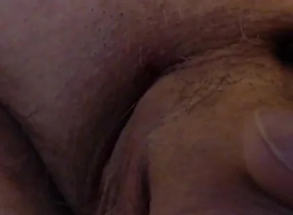 Limping Dick
