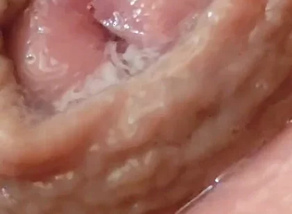 Juice From the Glans When Excited to the Extreme.