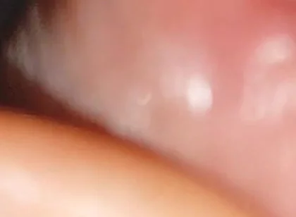 Hot Daddy in Close-up of the Inside of the Glans!