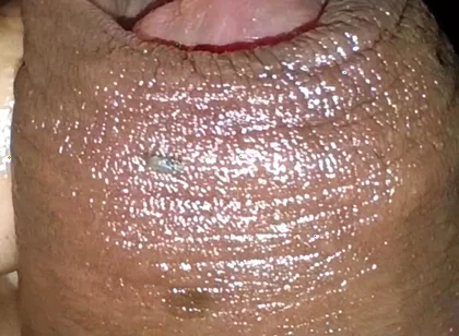 Close-up of Foreskin and Ejaculation in My Pants