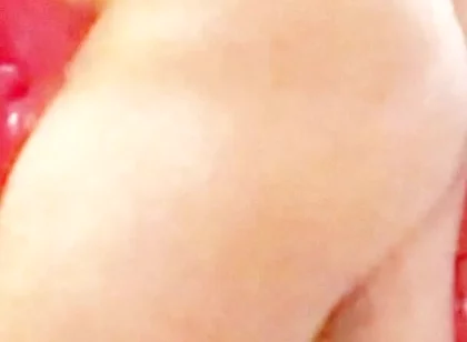Whip-lash