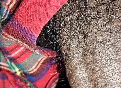 Close up on These Thick Veins
