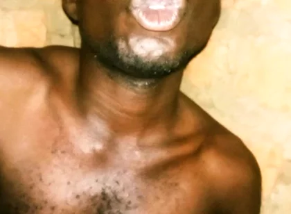 My Great Massaging and Maculation