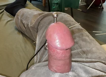 Acorn Acupuncture in a Cozy Cuddly Suit! Lots of Sperm!