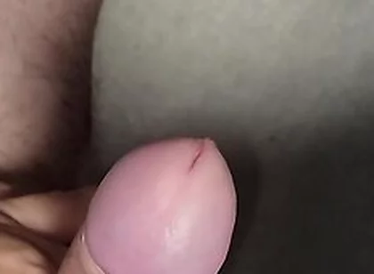 I Slowly Masturbated The Phimosis