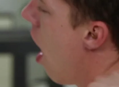 Exposed