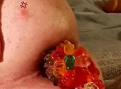 Big Load Of Gummy Bears Anal Stuffing And Expulsion Whit Prolapse