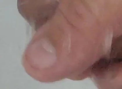 Strong Water in the Foreskin Excites the Glans Precum.