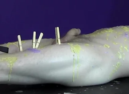 Pinching pegs leave welts