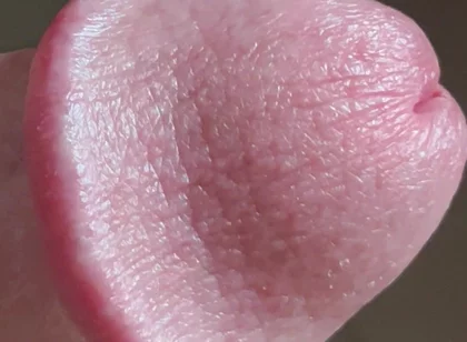 Closeup of Penis with One Vein