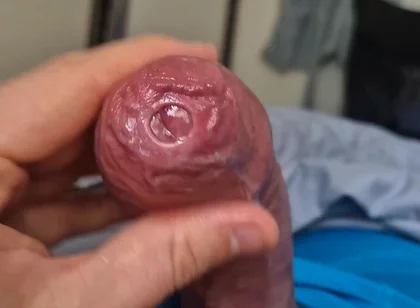 Phimosis Cock Precum Drip Close-up