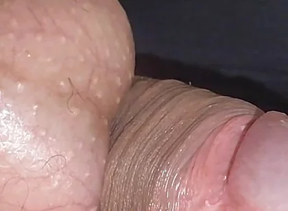 Amazing Upright Rough Venous Frenulum.