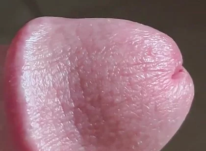 Closeup of Penis with One Vein