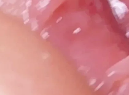 Extreme Dirty Daddy's Widened Hole.