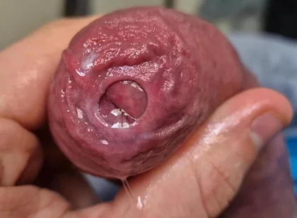 Uncut Head Precum Play