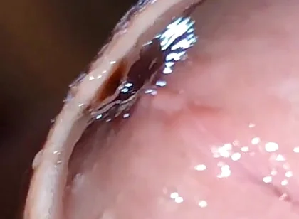 Glans Eye Watering After Intense Fucking.