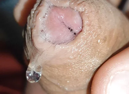 Glans Eye Watering After Intense Fucking