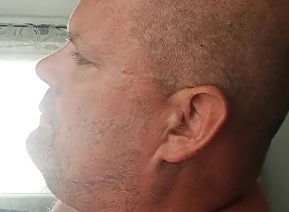 Renewed Destruction of the Bitch