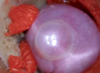 The Camera Inside the Deep Pussy Records a Huge Ejaculation with a Stuck Condom 4K