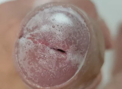 Extreme Burning Sensation Makes the Glans Foam with Arousal.