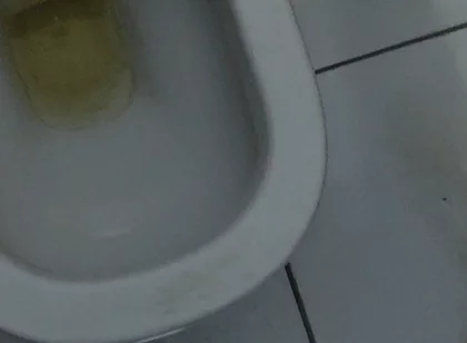 Homemade Method for Freezing the Penis
