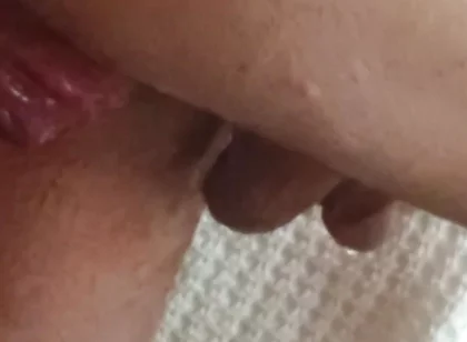 Prolapse and Urine