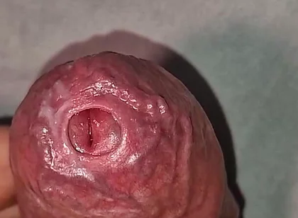 Close up on Phimosis Large Cock, so Hot!