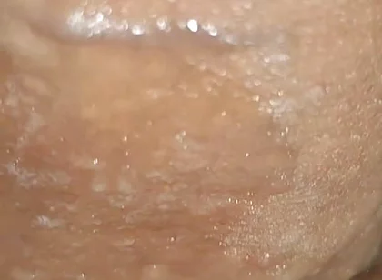 Scrotal Phimosis Results in an Extremely Hot Orgasm.