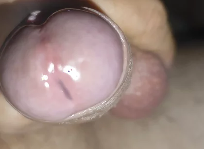 Scrotal Phimosis Results in an Extremely Hot Orgasm.