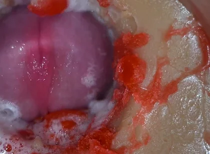Insemination - Internal Camera Captures Deep Male Ejaculation