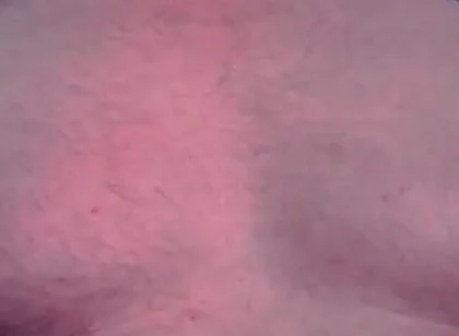 Brust Raus Nippel